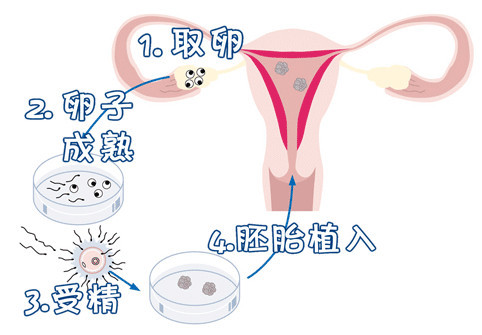 关于青碧生殖